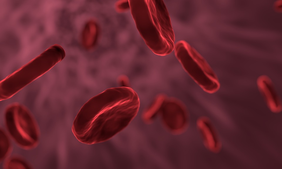 Anemia – właściwa diagnostyka i naturalne leczenie