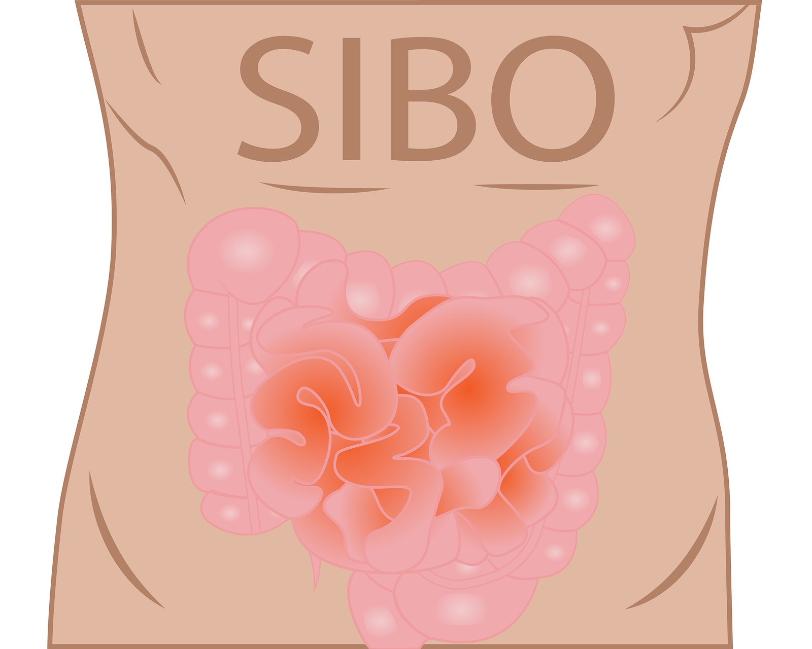 SIBO - Diagnostyka i leczenie. Przewodnik dla poczatkujacych.