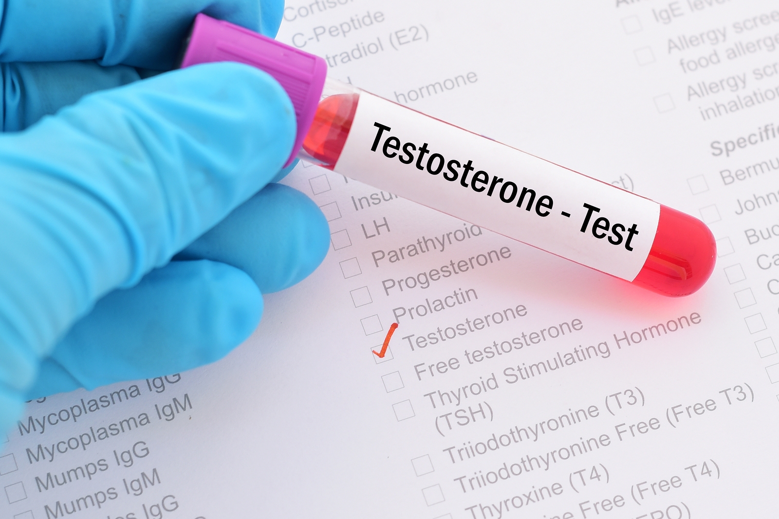 Testosteron – geny, czy środowisko?